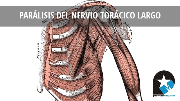 Dolor de hombro/cuello y discinesis escapular: parálisis del nervio torácico largo