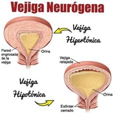 Vejiga Blog