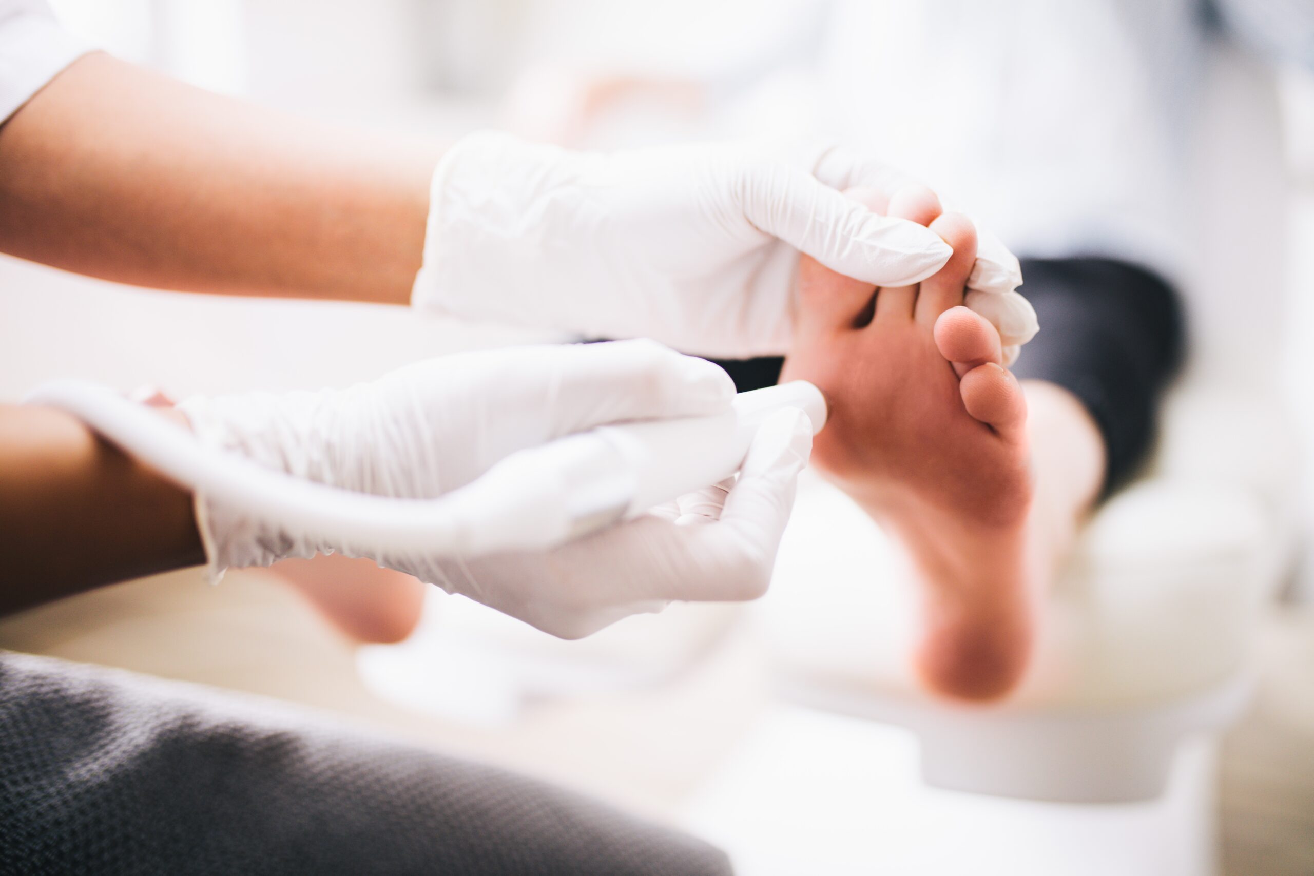 Neuroma de Morton
